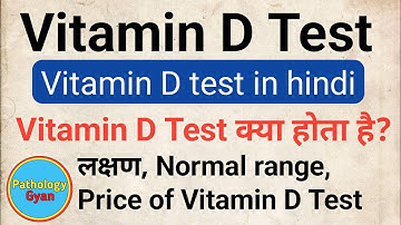 Vitamin D टेस्ट क्या होता है? | 25 Hydroxy test hindi | Vit D test in hindi